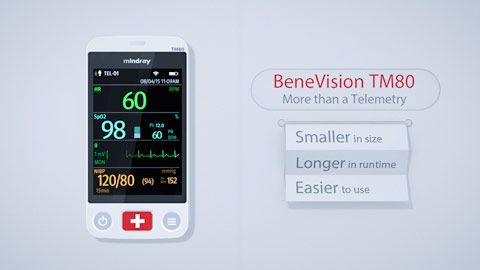 Mindray BeneVision TM80 l More Than a Telemetry