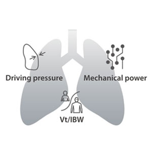 Mindray A7 Anesthesia Workstation - Image 11