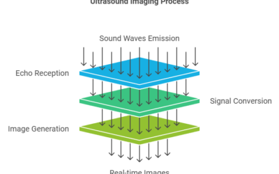 What is an Ultrasound Transducer