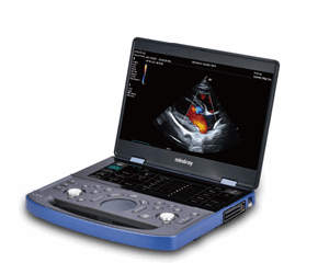 Best Portable Veterinary Ultrasound Machine for Clinical Efficiency and Diagnostic Confidence