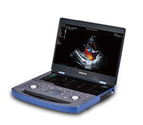 Veterinary Ultrasound Machine Veterinary Ultrasound Machine